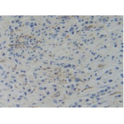 Tryptophanyl tRNA Synthetase (WARS) Antibody