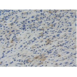 Tryptophanyl tRNA Synthetase (WARS) Antibody