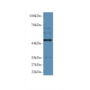 Western blot analysis of Human HepG2 cell lysate, using Rat WARS Antibody (2 µg/ml) and HRP-conjugated Goat Anti-Rabbit antibody (<a href="https://www.abbexa.com/index.php?route=product/search&amp;search=abx400043" target="_blank">abx400043</a>, 0.2 µg/ml).