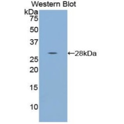 Tryptophanyl tRNA Synthetase (WARS) Antibody