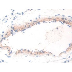 Tryptophanyl tRNA Synthetase (WARS) Antibody