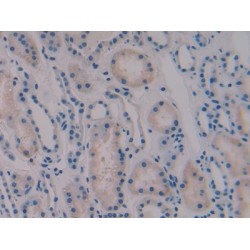 Vasoactive Intestinal Peptide (VIP) Antibody