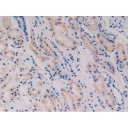 Vasoactive Intestinal Peptide (VIP) Antibody
