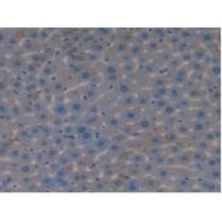 Vasoactive Intestinal Peptide (VIP) Antibody