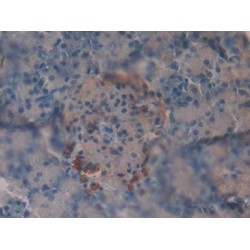 Vasoactive Intestinal Peptide (VIP) Antibody