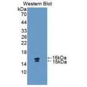 Western blot analysis of the recombinant protein.