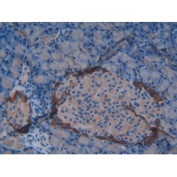 Vasoactive Intestinal Peptide (VIP) Antibody