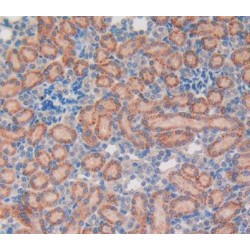 Vasoactive Intestinal Peptide (VIP) Antibody