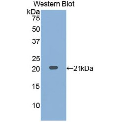 Prostatic Acid Phosphatase (ACP3) Antibody