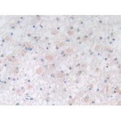 Prostatic Acid Phosphatase (ACP3) Antibody