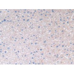 Prostatic Acid Phosphatase (ACP3) Antibody