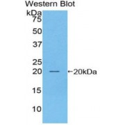 Western blot analysis of recombinant Mouse PAP/ACP3 Protein.