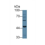 Western blot analysis of Human 293T cell lysate, using Human ACVR1B Antibody (3 µg/ml) and HRP-conjugated Goat Anti-Rabbit antibody (<a href="https://www.abbexa.com/index.php?route=product/search&amp;search=abx400043" target="_blank">abx400043</a>, 0.2 µg/ml).