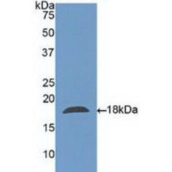 Charcot Leyden Crystal Protein (CLC) Antibody