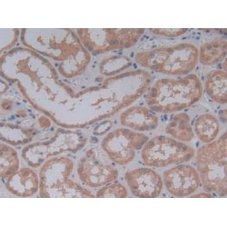 Charcot Leyden Crystal Protein (CLC) Antibody
