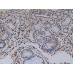 Charcot Leyden Crystal Protein (CLC) Antibody