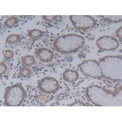Charcot Leyden Crystal Protein (CLC) Antibody