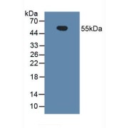 Western blot analysis of Human Urine.