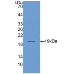 Cluster Of Differentiation 14 (CD14) Antibody