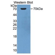 abx102972