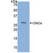 Western blot analysis of recombinant Mouse CD1d.
