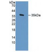 Western blot analysis of recombinant Human CD34.