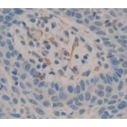 Hematopoietic Progenitor Cell Antigen CD34 (CD34) Antibody