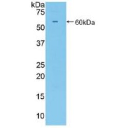 Hematopoietic Progenitor Cell Antigen CD34 (CD34) Antibody