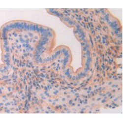 Hematopoietic Progenitor Cell Antigen CD34 (CD34) Antibody