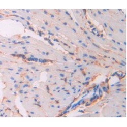 Hematopoietic Progenitor Cell Antigen CD34 (CD34) Antibody