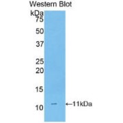abx102982