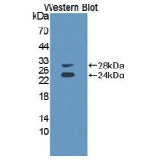 Western blot analysis of the recombinant protein.