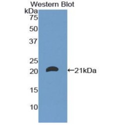 T-Cell Surface Glycoprotein CD8 Beta Chain (CD8B) Antibody