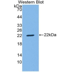 T-Cell Surface Glycoprotein CD8 Beta Chain (CD8B) Antibody