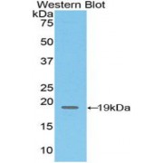 Western blot analysis of recombinant CD97.