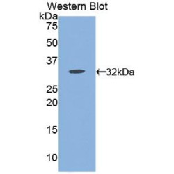 Cyclic ADP Ribose Hydrolase (CD38) Antibody