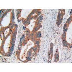 Disrupted In Schizophrenia 1 (DISC1) Antibody