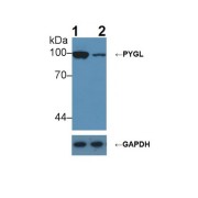 Western blot analysis of (1) Wild-type Hepg2 cell lysate, and (2) PYGL knockout Hepg2 cell lysate, using Rabbit Anti-Rat PYGL Ab (1 µg/ml) and HRP-conjugated Goat Anti-Mouse antibody (<a href="https://www.abbexa.com/index.php?route=product/search&amp;search=abx400001" target="_blank">abx400001</a>, 0.2 µg/ml).
