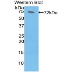 Heat Shock 70 kDa Protein 1B (HSPA1B) Antibody
