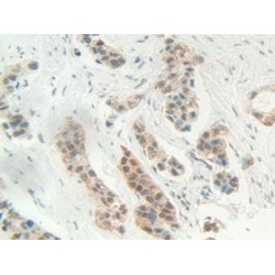 High Mobility Group Protein B1 (HMGB1) Antibody