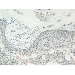High Mobility Group Protein B1 (HMGB1) Antibody