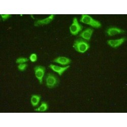 Complement C1q Binding Protein (C1QBP) Antibody