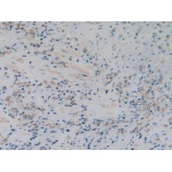 Complement C1q Binding Protein (C1QBP) Antibody