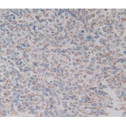 Complement C1q Binding Protein (C1QBP) Antibody