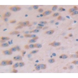 Complement C1q Binding Protein (C1QBP) Antibody