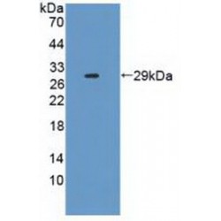 Interleukin 2 Receptor Alpha (IL2RA) Antibody