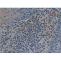 Interleukin 2 Receptor Alpha (IL2RA) Antibody