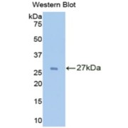 Western blot analysis of recombinant Rat IL2Ra Protein.