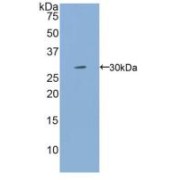 Western blot analysis of recombinant Human IL2Rg.