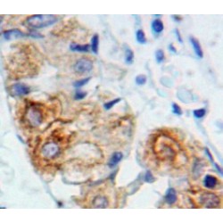 Interleukin 2 Receptor, Gamma (IL2RG) Antibody